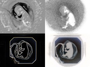 Josiane Keller - fetus Eileen four ultrasound test pics