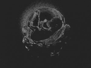 Josiane Keller - fetus Eileen with placenta 2 - res72
