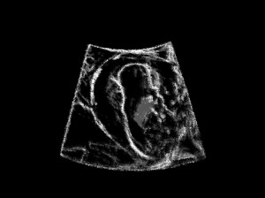 Josiane Keller - Eileen ultrasound test pic 2a
