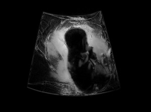 Josiane Keller - Eileen ultrasound test pic 2b