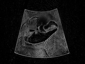 Josiane Keller - Eileen ultrasound test pic 2c