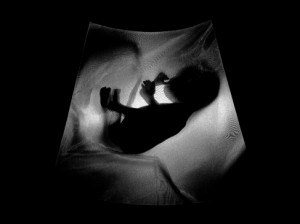 Josiane Keller - Eileen ultrasound test pic 2e