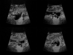 Josiane Keller - 4 Eileen stills ultrasound
