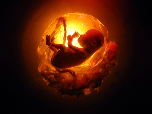 Josiane Keller - fetus Eileen with placenta 2